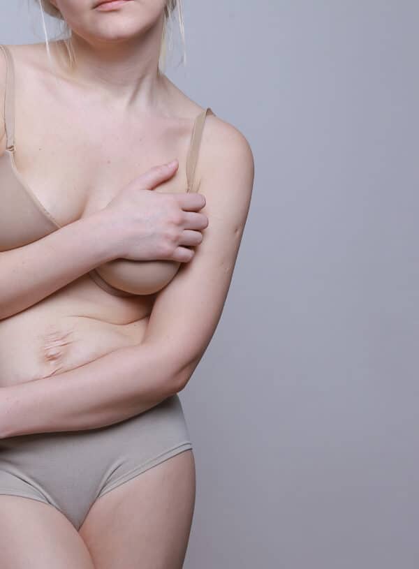 Benefits of Dermal Fillers – What You Need to Know