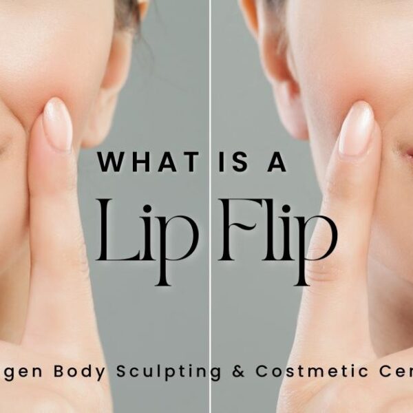 before and after photo of a woman with bigger lips from filler