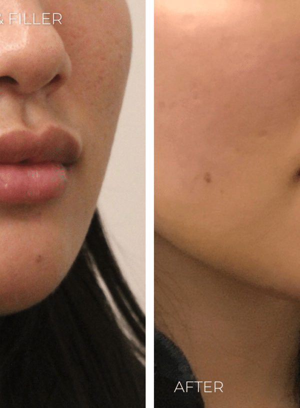 Discover the Real Science Behind Beauty Fads – The Latest Treatments